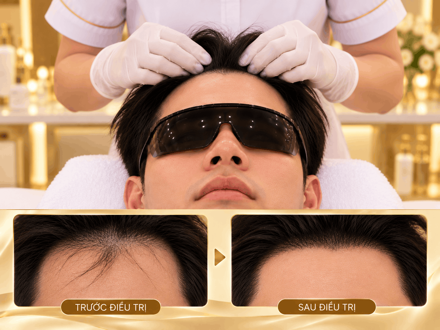 Định hình chân tóc